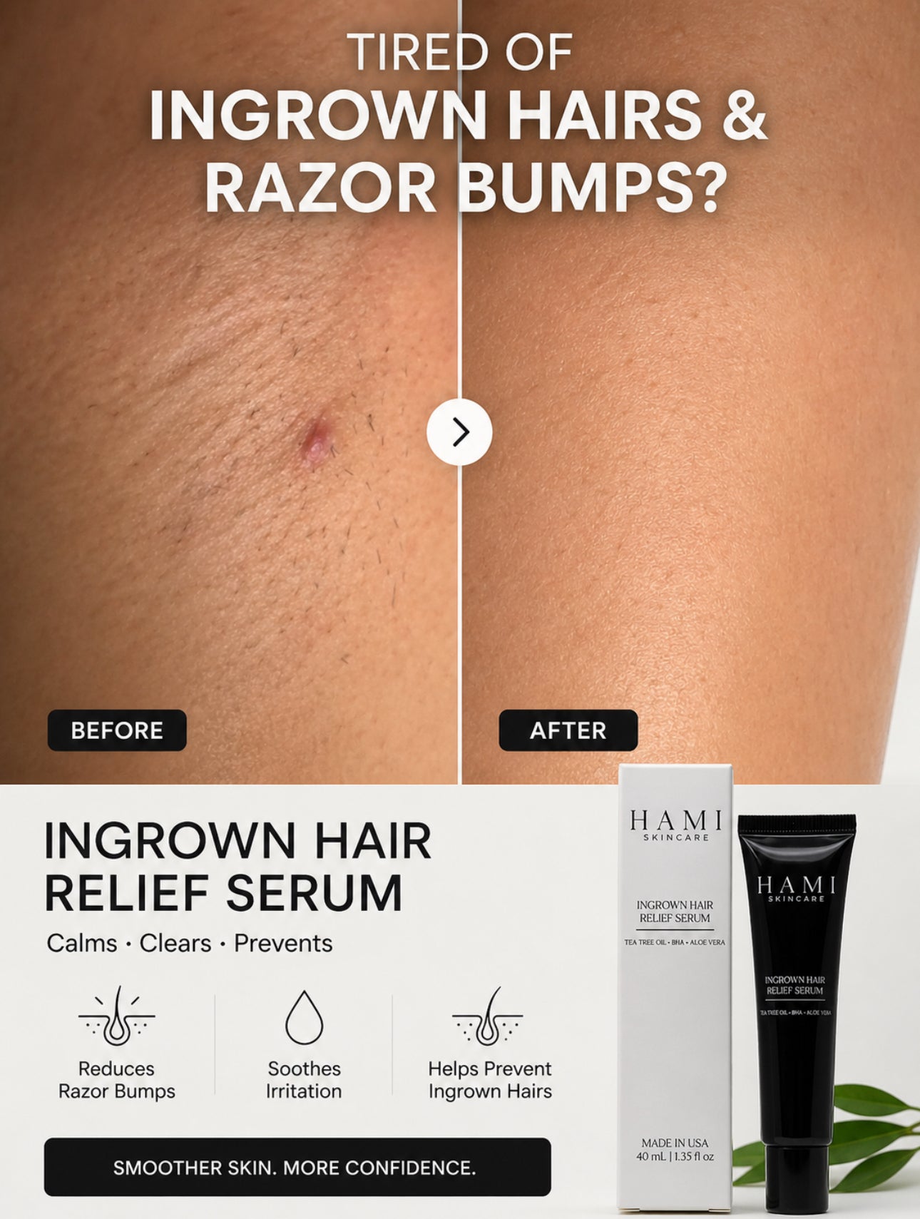INGROWN HAIR RELIEF SERUM